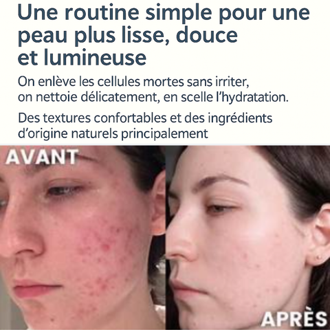 Pack Pureté Radieuse — Purifie, équilibre et illumine naturellement
