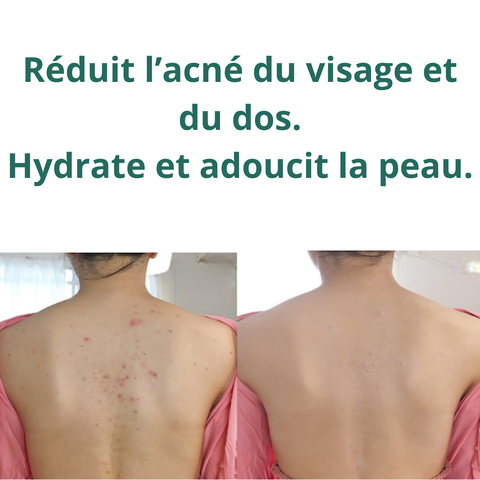 Routine Sérénité Douceur — Apaisez et nourrissez votre peau sensible.