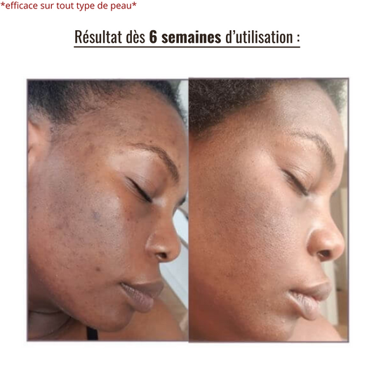 Pack Peau Lisse & Éclat Hydraté