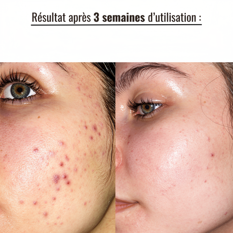Pack Pureté Radieuse — Purifie, équilibre et illumine naturellement